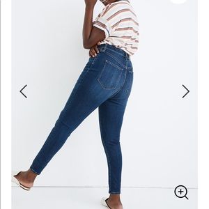 Madewell Curvy High-waisted Skinny Jeans